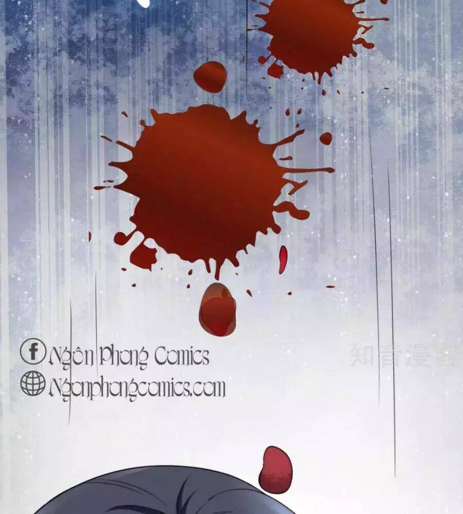 Sủng Hậu Của Vương: Chapter 17