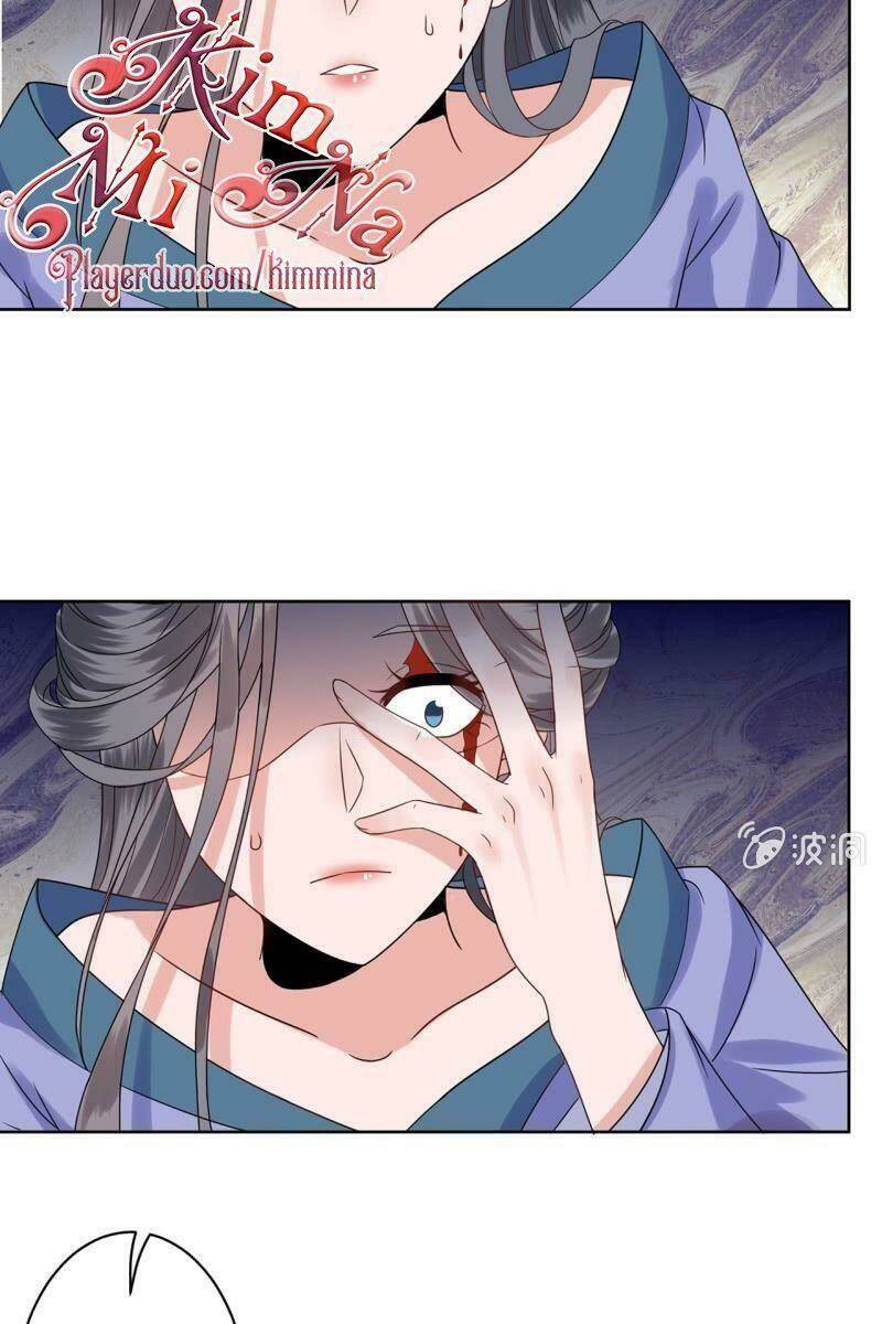 Vương Gia Kiêu Ngạo Quá Khó Cua: Chapter 28