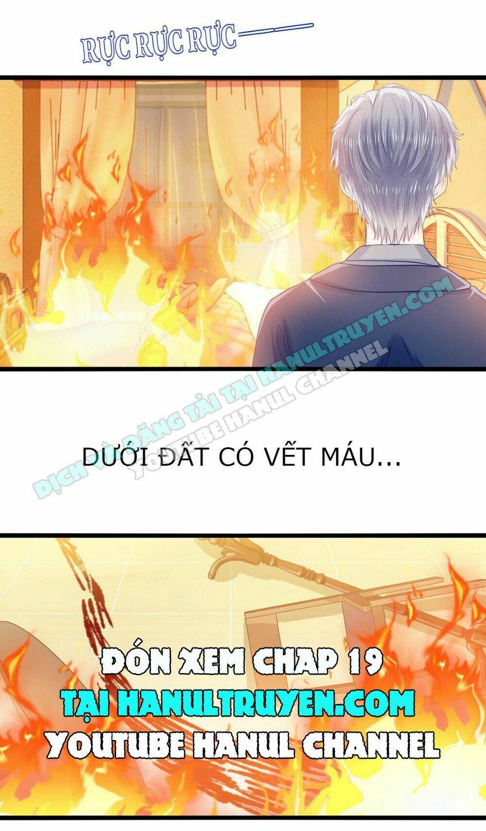 Lăng Thiếu! Nhẹ Một Chút, Đau: Chapter 18