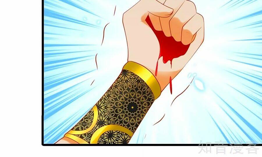 Sủng Hậu Của Vương: Chapter 50