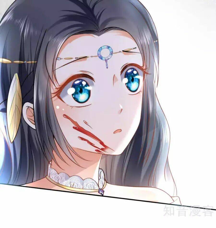 Sủng Hậu Của Vương: Chapter 17