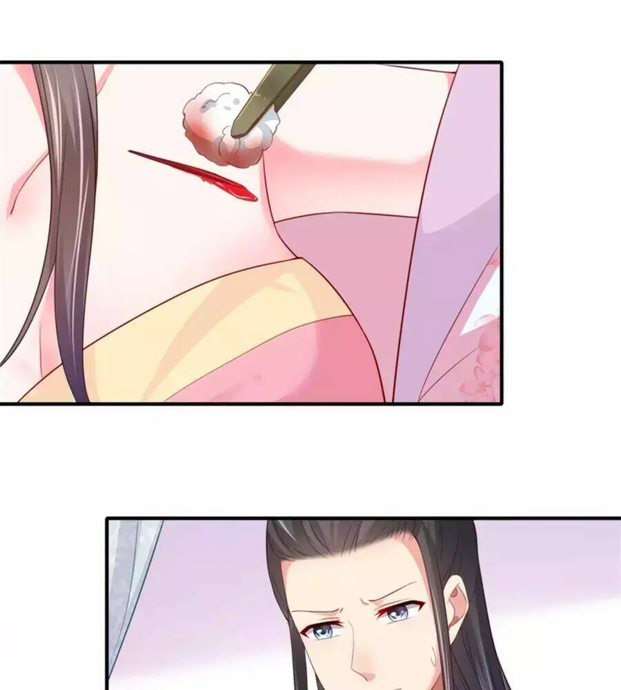 Khuynh Thế Y Phi Muốn Bỏ Chồng: Chapter 122