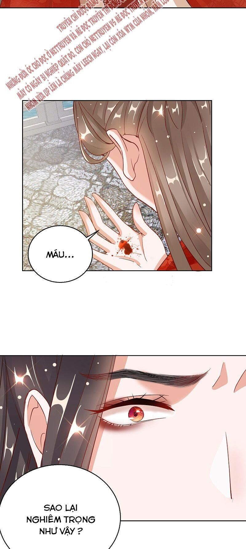 Công Lược Trưởng Thành Của Vương Phi: Chapter 25