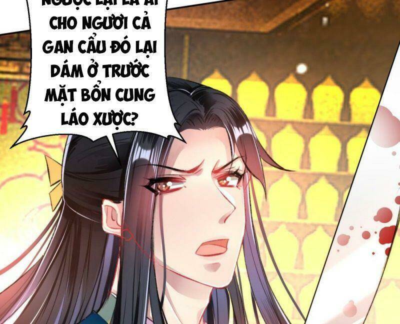 Vương Gia, Áo Lót Của Ngươi Rơi Mất Rồi: Chapter 58