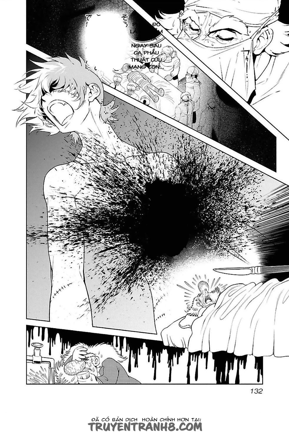 Thời Niên Thiếu Của Black Jack: Chapter 34