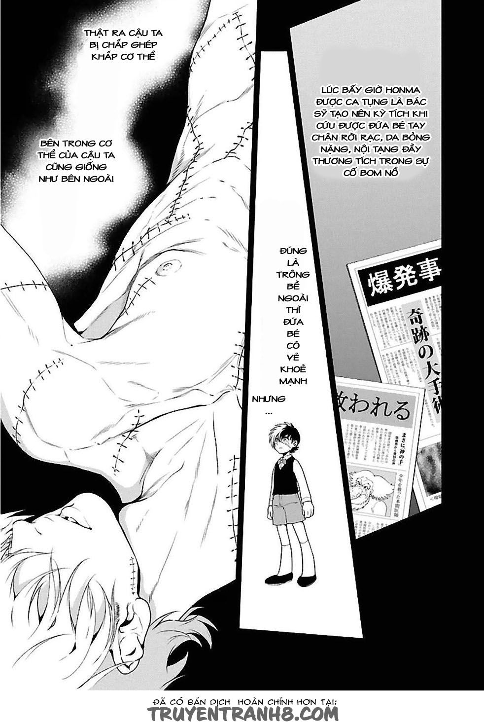 Thời Niên Thiếu Của Black Jack: Chapter 28