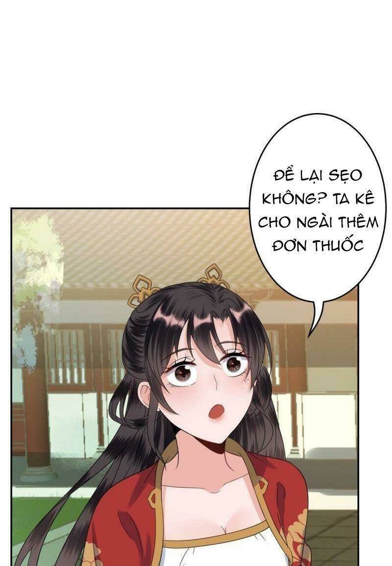 Vương Gia Kiêu Ngạo Quá Khó Cua: Chapter 43