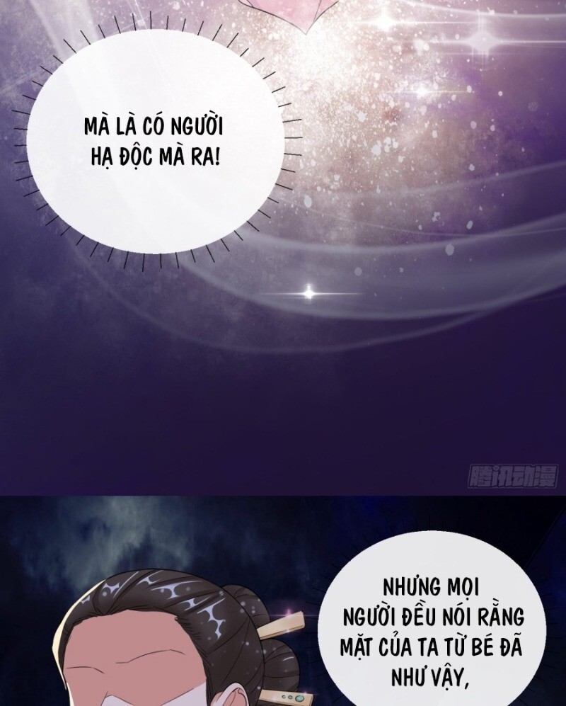 Công Lược Trưởng Thành Của Vương Phi: Chapter 11