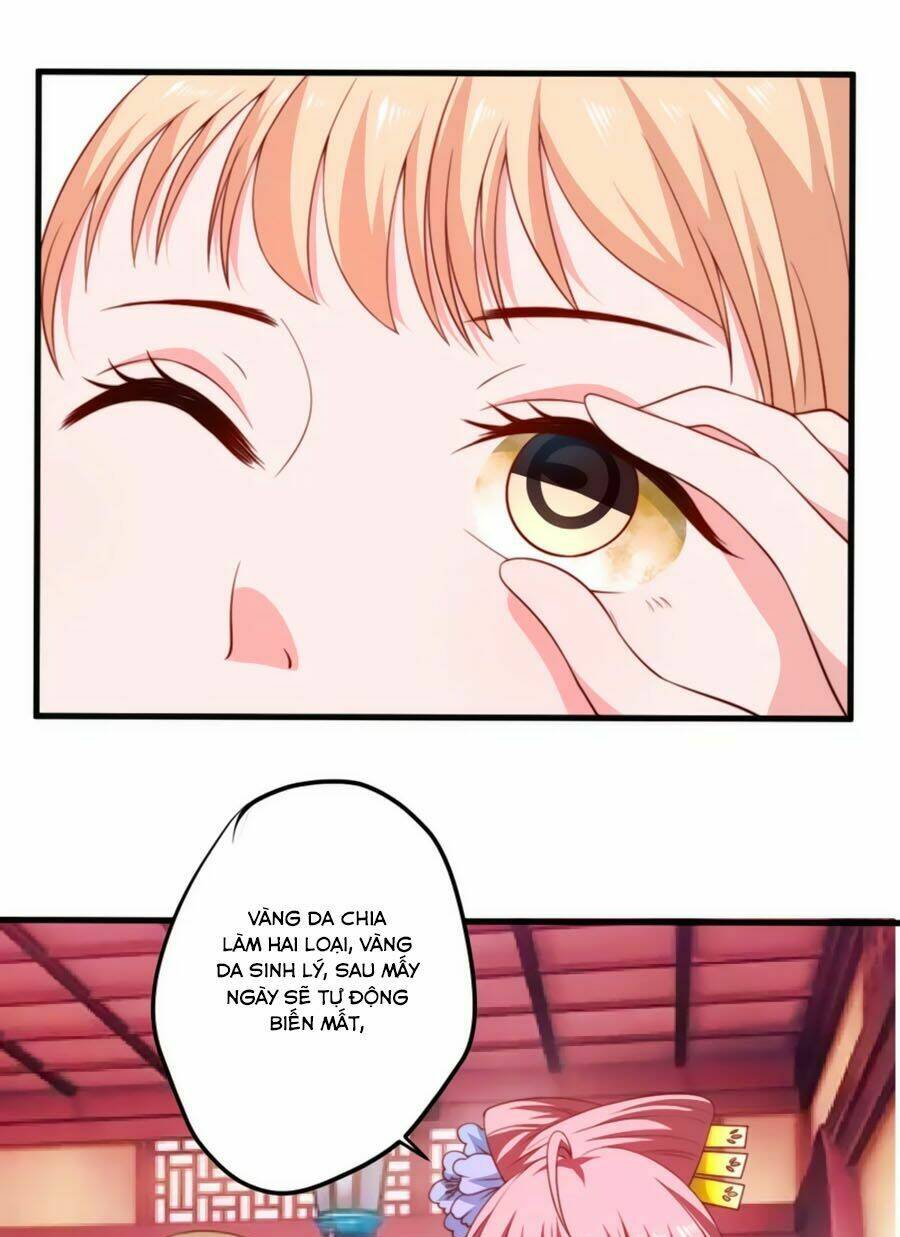 Khuynh Thế Y Phi Muốn Bỏ Chồng: Chapter 14