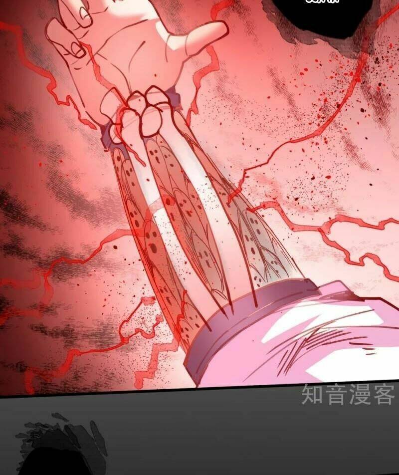 Tối Cường Đại Biểu Hoàng Kim Thận: Chapter 104